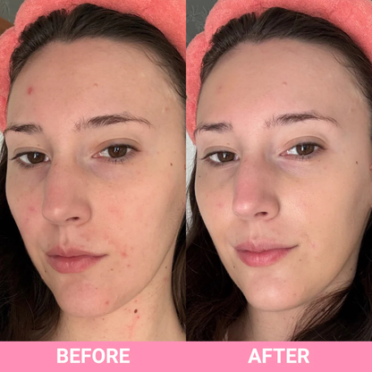 Teaology - Serum CALMING Centella Cica Infusion