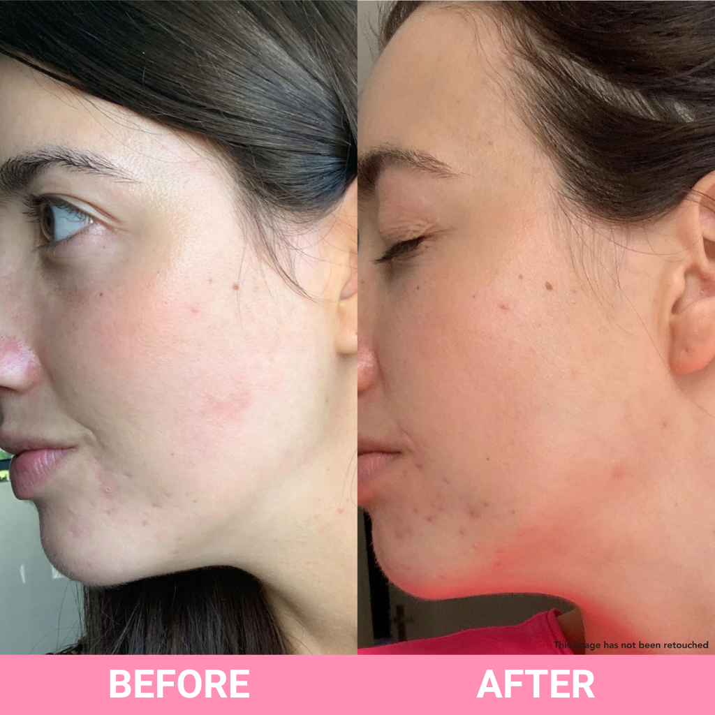 Teaology - Serum HYDRATE Hyaluronic Infusion