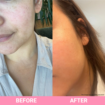 Teaology - Serum HYDRATE Hyaluronic Infusion