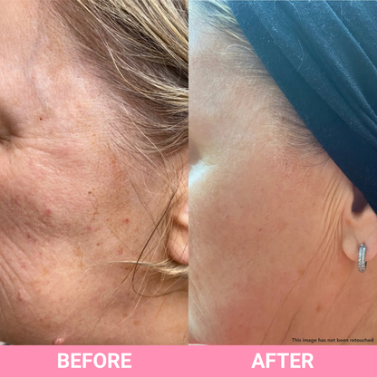 Teaology - Serum ANTI-AGE Peptide Infusion