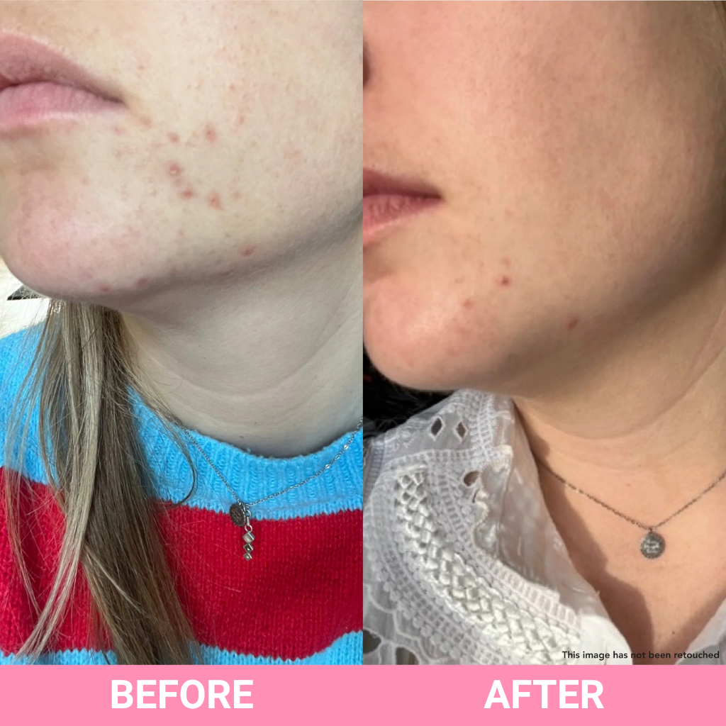 Teaology - Tea Glow Exfoliating Cleansing Foam