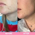 Teaology - Tea Glow Exfoliating Cleansing Foam