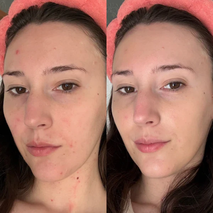 Teaology - Serum Centella Cica Infusion